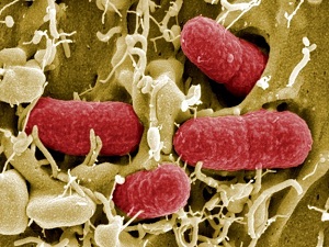 Corona virüsü"nden ölümler artıyor