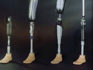 Protez bacakla kağıt topluyor