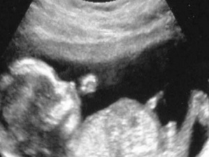 'Gebe Okulları' açılıyor