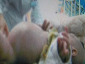 İki yaşındaki bebek ikizini doğurdu!