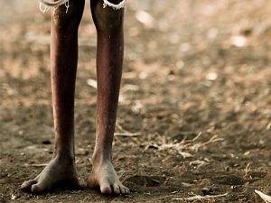 Dünyada 81 milyon insan yardıma muhtaç