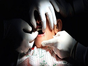 Deve kuşu yumurtasından kemik dolgusu üretildi