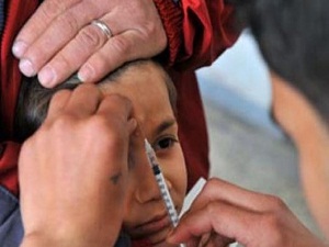 Şark çıbanı ile ilgili rahatlatan açıklama