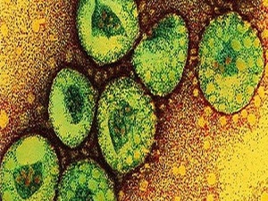 DSÖ: MERS, küresel aciliyet oluşturmuyor