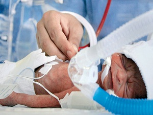 Her 10 bebekten biri prematüre doğuyor