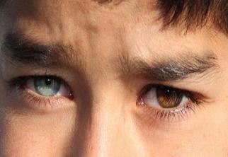 Küçük Münir'in gözleri 'Van kedisi' gibi