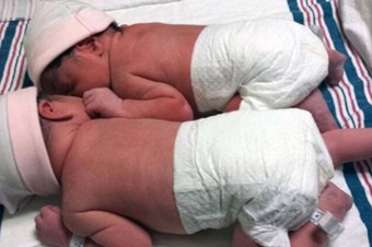 İkizler ama aynı yıl doğmadılar