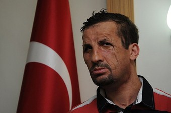 Türkiye yüz nakillerinde dünya liderliğine oynuyor