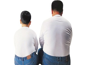 Obezite ömür kısaltıyor