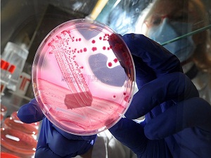 Kanser hücrelerini gösteren gözlüğün denemesi yapıldı