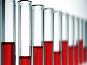 Kas hastalarına müjde