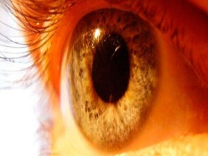 Sarı noktada vitamin etkisi