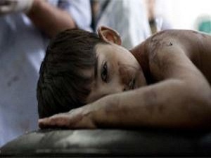 Anestezi yerine demir çubuklarla bayıltılıyorlar!