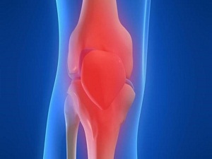 Menisküsten korkmayın