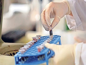 Kemik iliği Nakillerinde Avrupa'nın liderliğine oynuyoruz fakat...