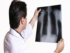 Uzun süren öksürüğe dikkat