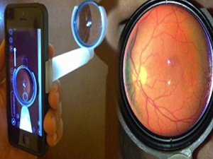 iPhone ile Göz Muayenesi Yapıldı!