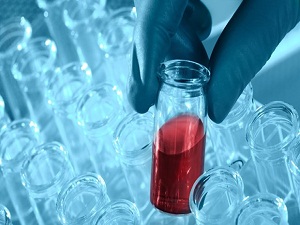 Kanserden ölen kişi sayısı 69 bin