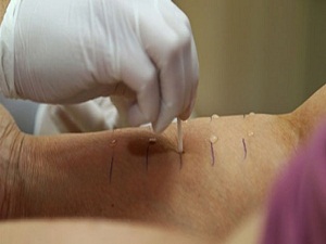 Modern kent yaşamı alerjiyi besliyor