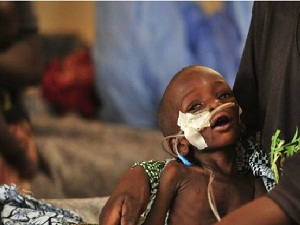 Yeryüzü Doktorları: Bebekler açlığa dayanamaz