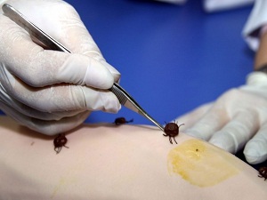 Erzurum'da KKKA şüphesi