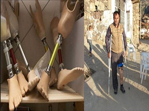 Gazze'deki engellilerin protez sevinci