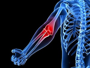 Kireçlenme ve ağrıdan kurtulmak mümkün mü?