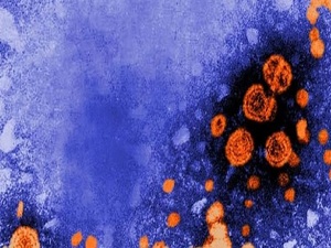 Aşıya rağmen görülüyor