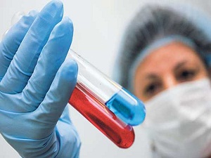 Kan testi kılavuzu ile hastaneler arasında sonuç farkı olmayacak