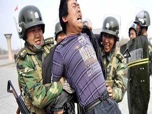 Uygurlara çip işkencesi