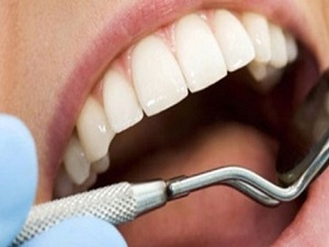 Anne adaylarına diş sağlığı uyarısı