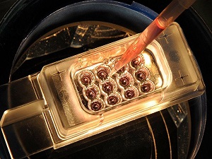 DSÖ Ebola salgını için toplantı yapacak