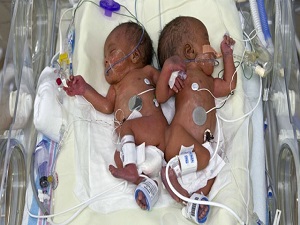 Genlerin etkisi sanılandan daha fazla