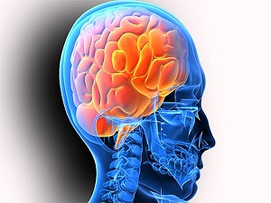 Aşırı sıcak havalar nörolojik hastaları daha çok etkiliyor