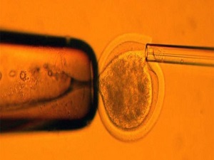 Kıkırdak hasarlarına kök hücreli çözüm