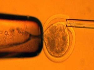 Kıkırdak hasarlarına kök hücreli çözüm