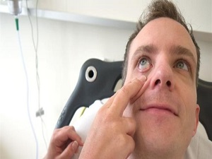 Göz içi merceklerle gözlüklerden kurtulun