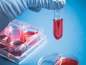 Kalp yetmezliği hastalarına yeni ilaç ümit olacak