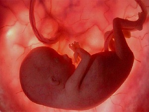 Anne karnındaki bebeğin genetik hastalığı 1 haftada öğrenilecek