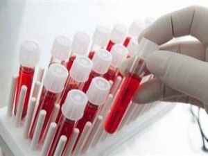 Ebola Aşısı İçin Tarih Belli Oldu