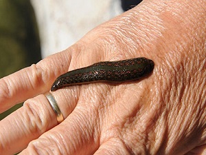 Müzik ve sülük tıbbi tedavide kullanılacak