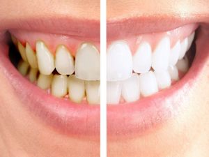 Dozu ve İçeriği İyi Ayarlanmalı