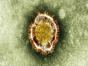 700 bin kişi tehlike altında