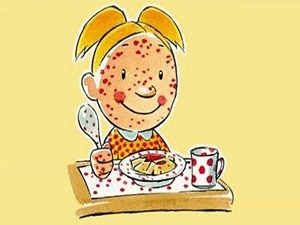 Besin alerjisi tanısı konulan çocuk için acil eylem planı yapılmalı