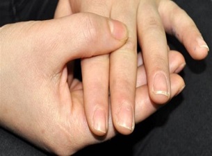 Tırnaklarınızdaki değişime dikkat !