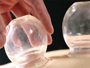 Hacamat ve Akupunktur Yönetmeliği yürürlükte