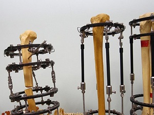 Yerli medikal cihazlarda Van imzası olacak