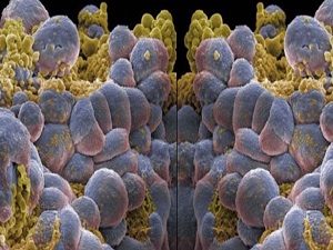 Her yıl bin 500 kişi lösemiye yakalanıyor