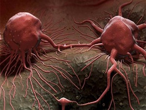 Türkiye kanser ilacı üretecek