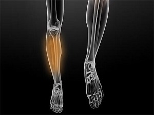 Uyandıran bacak ağrısına dikkat!